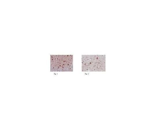 62-8466-10 Anti-EVI-5 Antibody ABN194