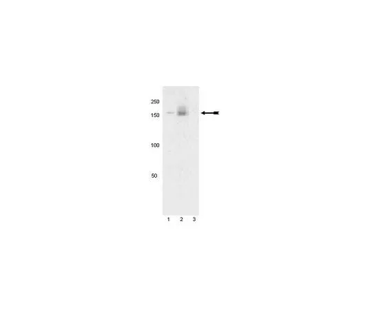 62-8386-85 anti-phospho-PDGFRα (Tyr742); 100 μL 07-861