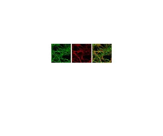 62-8446-55 Anti-Doublecortin; 50 μL AB2253