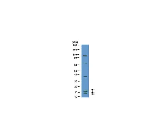 62-8374-29 Anti-VEGF, clone CH-10; 100 μg 05-1116
