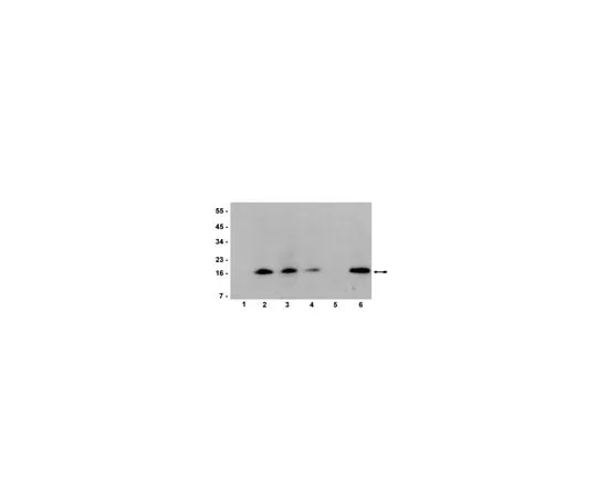 62-8373-02 Anti-trimethyl-Histone H3 (Lys36), clone MC86; 100 μL 05-801