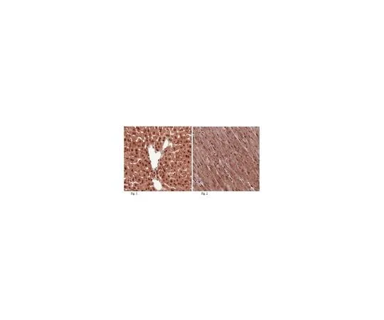 62-8459-68 Anti-THAP11 (Ronin); 100 μg ABD75