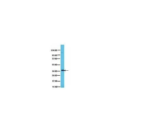 62-8387-20 Anti-PP1γ1; 100 μg 07-1218
