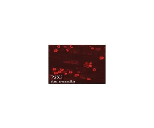 62-8451-87 Anti-P2X3 Receptor, pain; 50 μL AB5896
