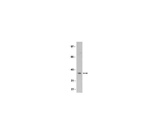 62-8385-52 Anti-Spry2; 200 μg 07-524