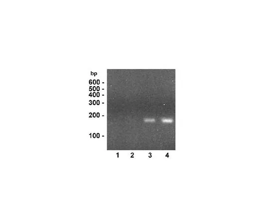 62-8393-32 EZ-ChIP(TM); 22 assays 17-371