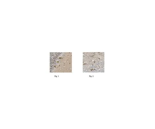 62-8456-99 Anti-TMEM132A ABC148