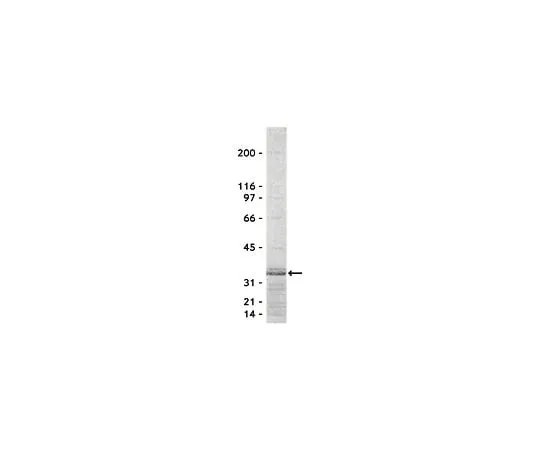 62-8391-40 Rho Assay Reagent (Rhotekin RBD, agarose); 650 μg 14-383