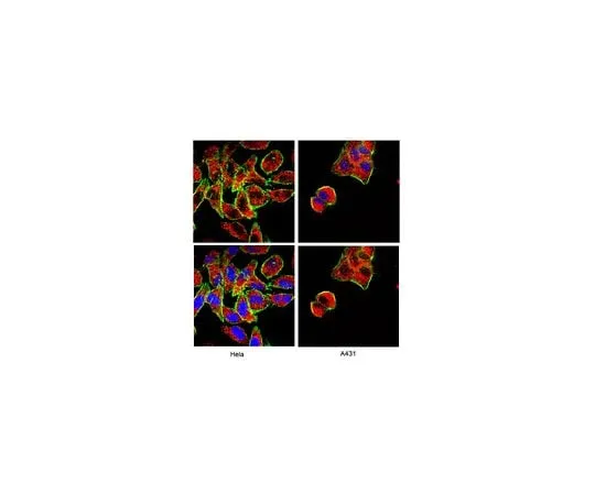 62-8381-56 Anti-Bak, NT; 200 μg 06-536