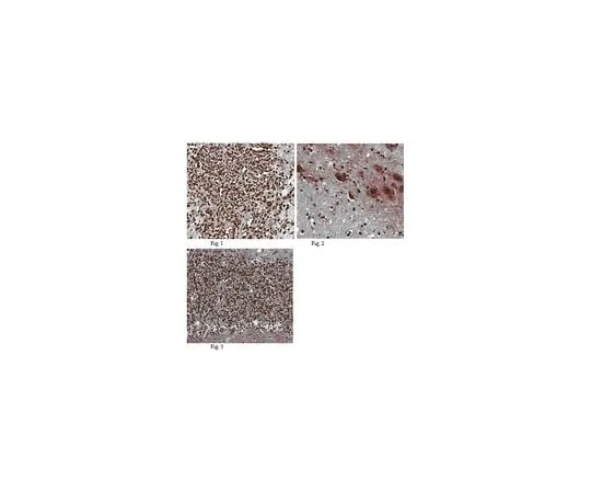 62-8456-67 Anti-HUNK; 100 μg ABC91
