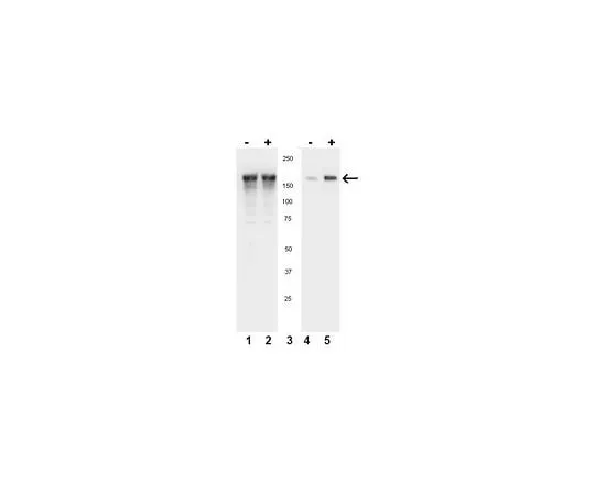 62-8386-70 anti-phospho-EGFR (Tyr1086); 100 μL 07-818
