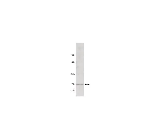 62-8384-37 Anti-Cofilin 2; 200 μg 07-300