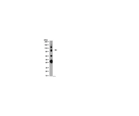 62-8446-57 Anti-GABA B Receptor R1; 50 μL AB2256