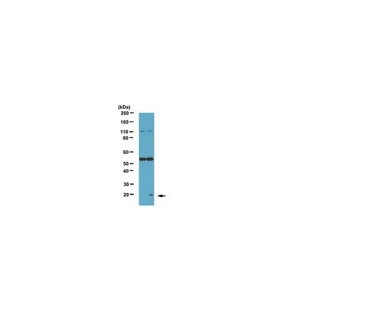 62-8454-37 Anti-Phospho- Bad (Ser75); 100 μg AB10423