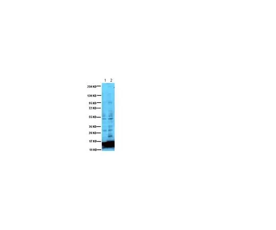 62-8448-62 Anti-Acetyl Lysine; 100 μg AB3879