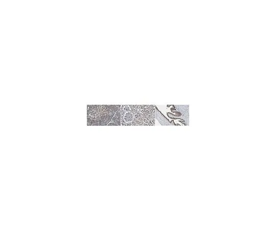 62-8381-94 Anti-FADD; 200 μg 06-711