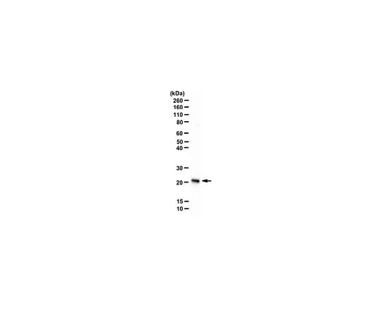 62-8450-65 Anti-Recoverin Antibody AB5585-I