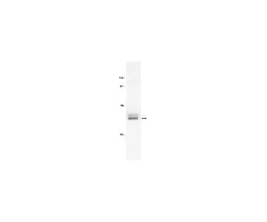62-8381-72 Anti-Lck; 200 μg 06-583