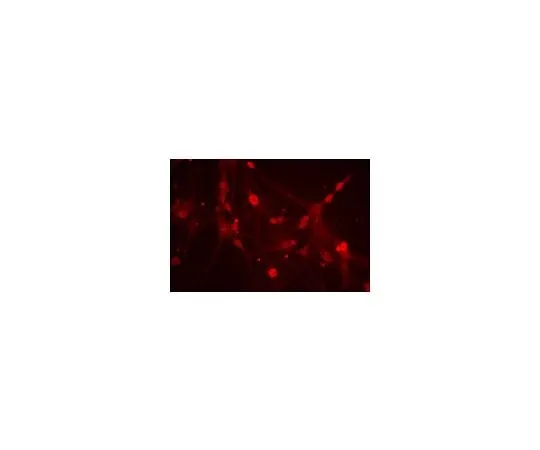 62-8451-06 Anti-ATH 1; 100 μg AB5692