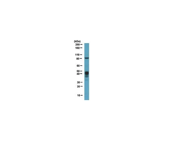 62-8460-80 Anti-MBNL1; 100 μg ABE241