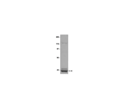 62-8384-85 Anti-PRMT1; 200 μg 07-404