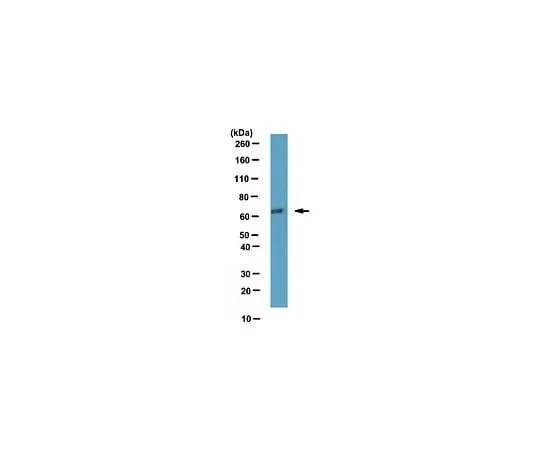 62-8461-05 Anti-ATDC; 100 μg ABE302