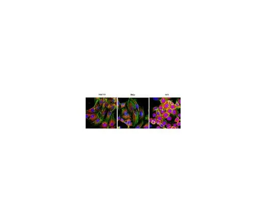 62-8452-28 Anti-F-actin-capping protein subunit alpha-1; 100 μg AB6016