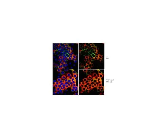 62-8388-53 Anti-phospho-Ribosomal Protein S6 (Ser240/Ser244); 100 μg 7-13