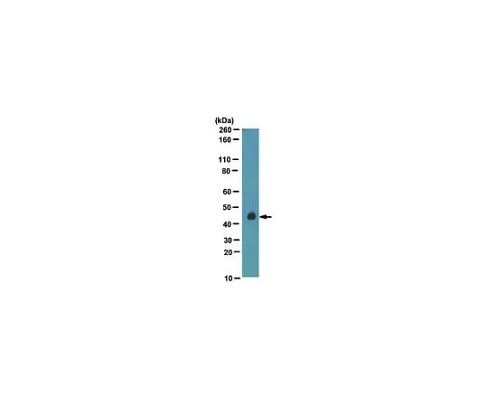 62-8465-28 Anti-mHUMMR; 100 μg ABN23