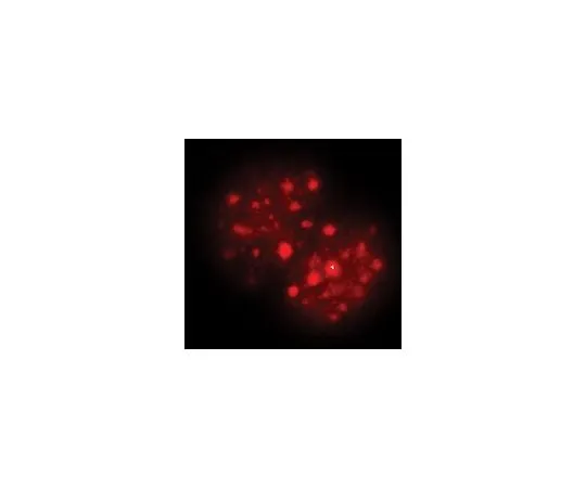 62-8385-10 Anti-trimethyl-Histone H3 (Lys9); 100 μg 07-442