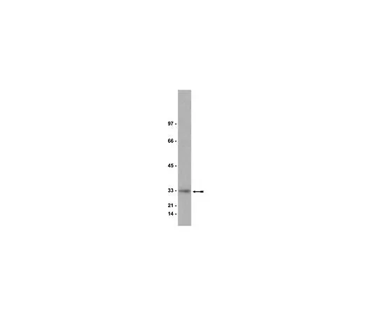 62-8381-38 Anti-Kip1 (p27); 200 μg 06-445