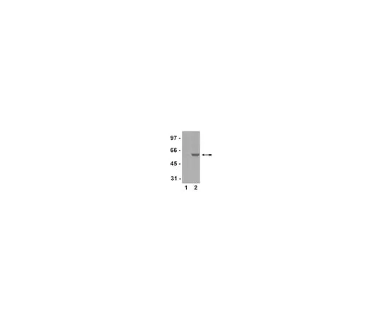 62-8368-98 Anti-phospho-Smad2 (Ser465/467), clone A5S; 100 μL 04-953