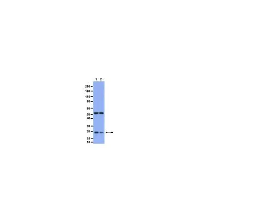 62-8447-05 Anti-Phospho-Bid (Ser65); 100 μg AB2994