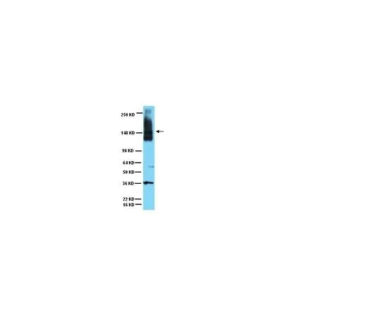 62-8449-02 Anti-Neural Cell Adhesion Molecule; 50 μg AB5032