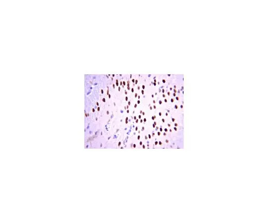62-8446-60 Anti-Tbr1; 100 μg AB2261