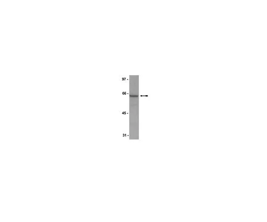 62-8384-96 Anti-SHP-1/SHPTP-1; 200 μg 07-419