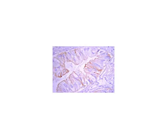 62-8374-84 Anti-cPhospholipase A2, clone CH-7; 100 μg 05-1406