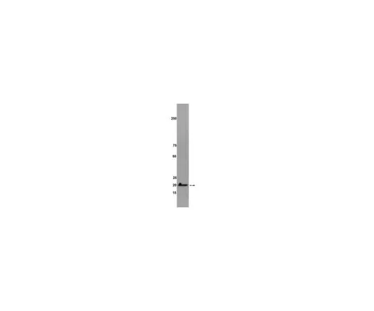 62-8368-34 Anti-RhoG, clone 1F3 B3 E5; 100μg 04-486