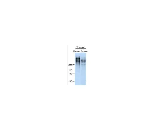 62-8456-17 Anti-Tenascin; 50 μg AB19011
