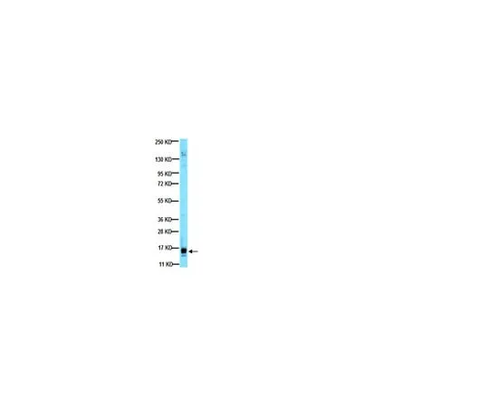 62-8374-30 Anti-Vascular Endothelial Growth Factor, clone VG1; 100 μL 05-1117