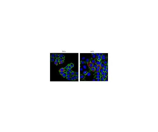 62-8447-04 Anti-p32; 100 μg AB2991