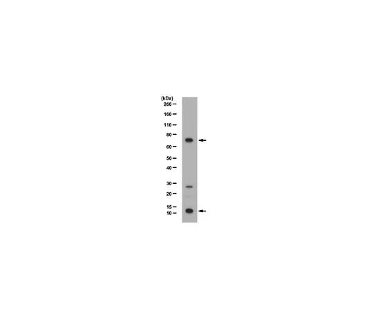 62-8460-39 Anti-PRDM5; 100 μg ABE114
