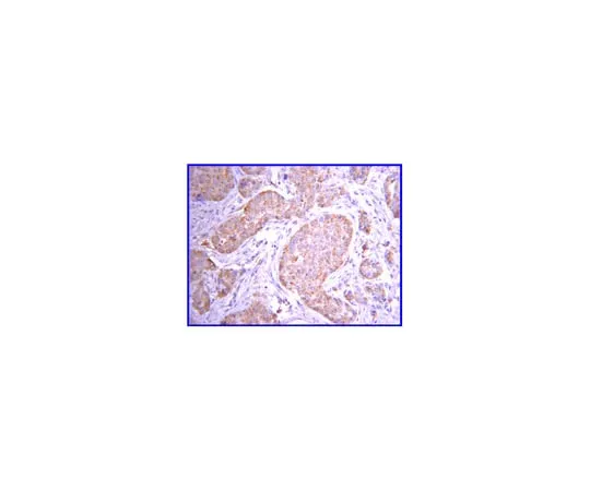 62-8367-80 Anti-JAK2, clone 8E10.2; 100 μg 04-001