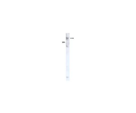 62-8371-50 Anti-ATM, clone AM9; 200 μL 05-513