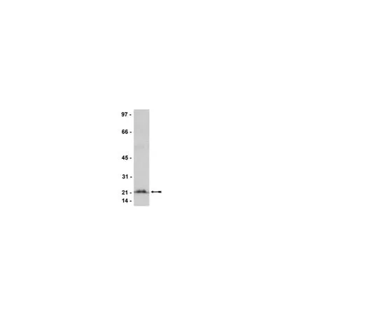 62-8368-75 Anti-Rho (-A, -B, -C), clone 3L74; 100 μL 04-822