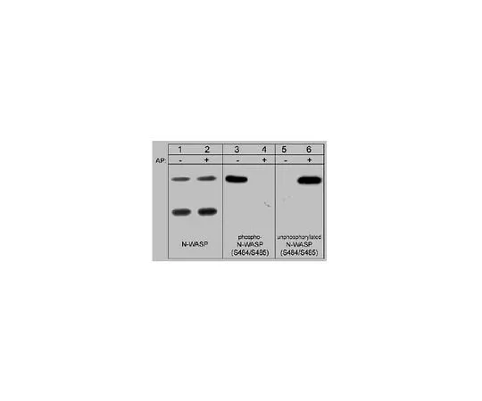 62-8446-15　Anti-N-WASP, phospho-specific [Ser484/Ser485]; 100 μL　AB1964