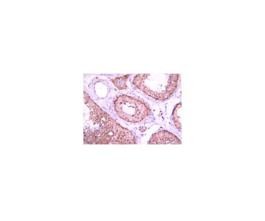 62-8387-25 Anti-Protein Phosphatase 5 (PP5);100 μg 07-1225