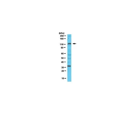 62-8460-21 Anti-PTIP; 100 μL ABE69
