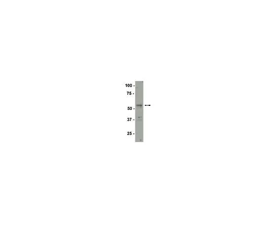 62-8385-94 Anti-SF-1; 200 μg 07-618