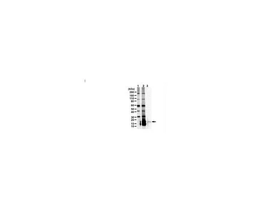 62-8468-14 Anti-C9ORF72/C9RANT (Poly-PR) ABN1354